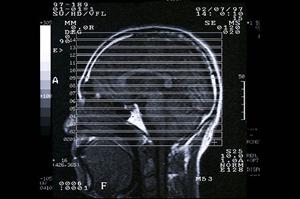 柏でのインプラント治療ガイド：信頼できる医院と費用を徹底解説！