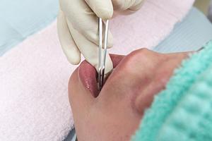 大阪でおすすめの美容皮膚科完全ガイド！しみ・ニキビ・脱毛治療の全貌を解説