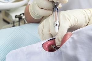 治療前の疑問を解決できる藤沢の矯正歯科