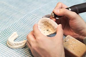 盛岡市で歯科医院選びのポイントとは