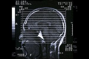 とても丁寧なカウンセリングが評判